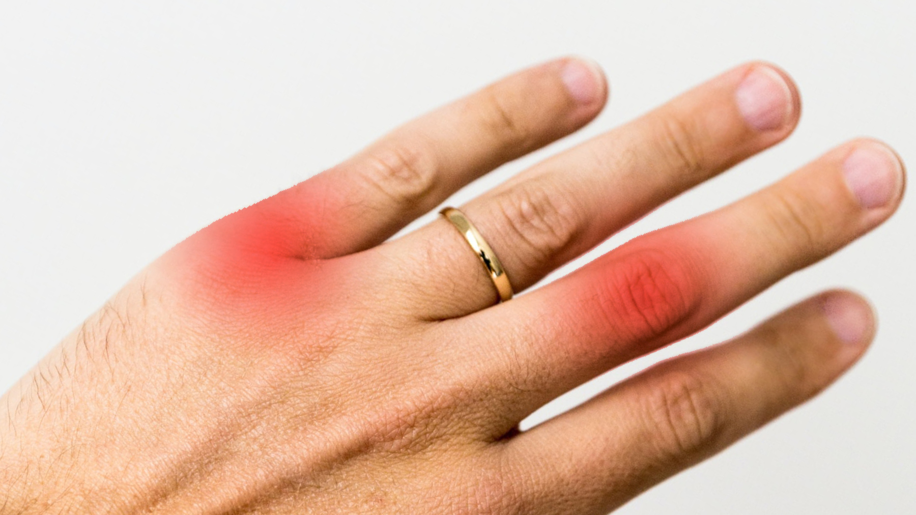 Coping With Arthritis RH Uncovered